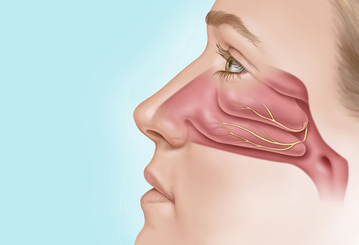 chronic rhinitis treatment near you boise normal nasal cavity ENT