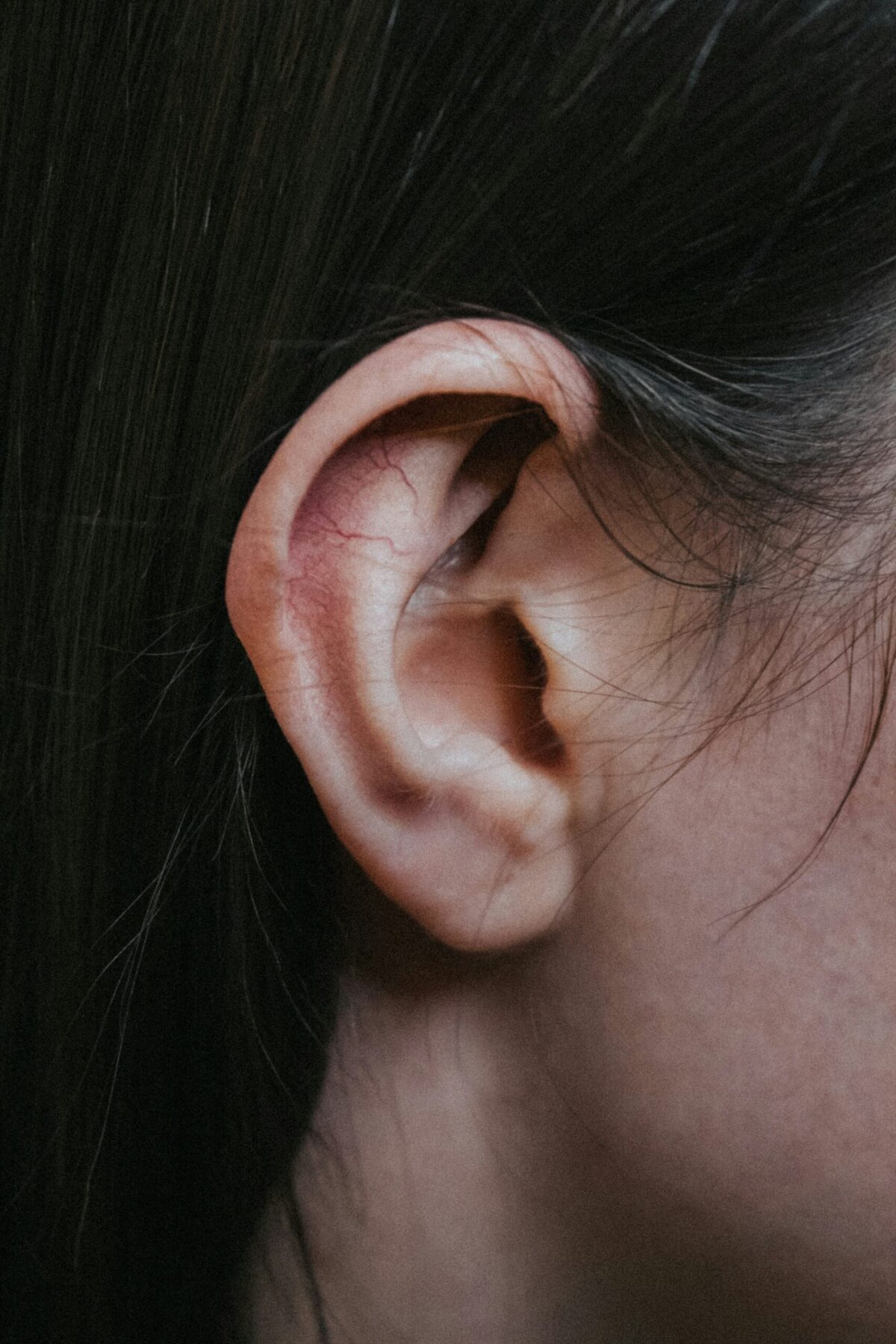 ear with prominent veins representing itchy ears